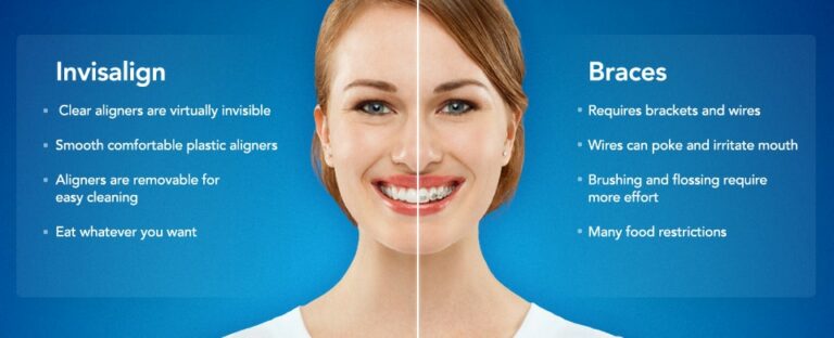 Smile South Florida Cosmetic Dentistry Announces the “Straight Teeth for Summer” Invisalign Special