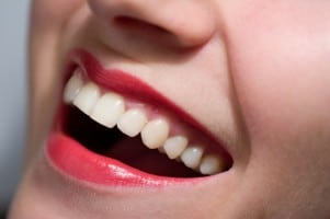 Dental Implants Fort Lauderdale – Improve your Smile