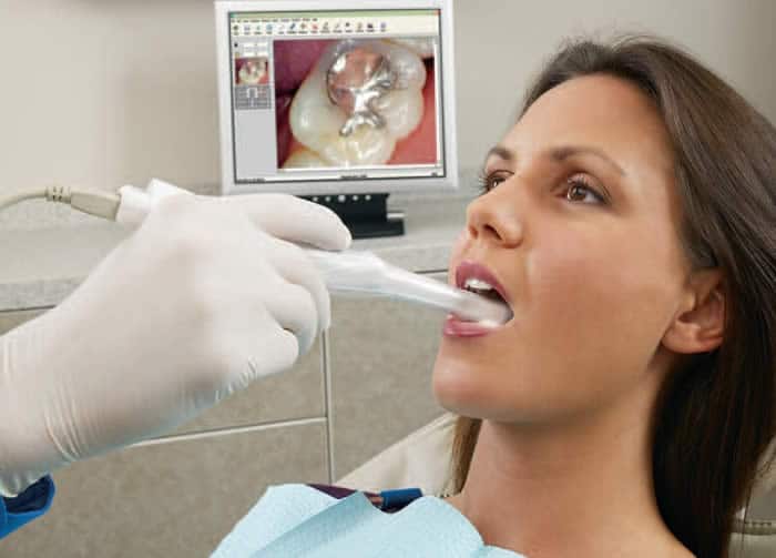 Advanced Dental Technology for Better Diagnosis