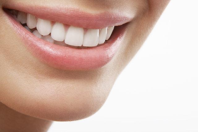 7 Advantages of Porcelain Veneers You Didn’t Know